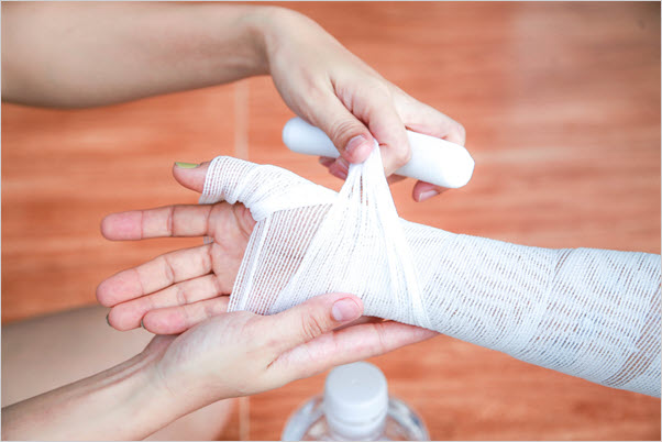 A scalded hand being bandaged.